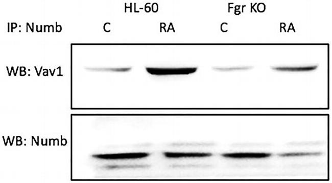 NUMB Antibody in Immunoprecipitation (IP)