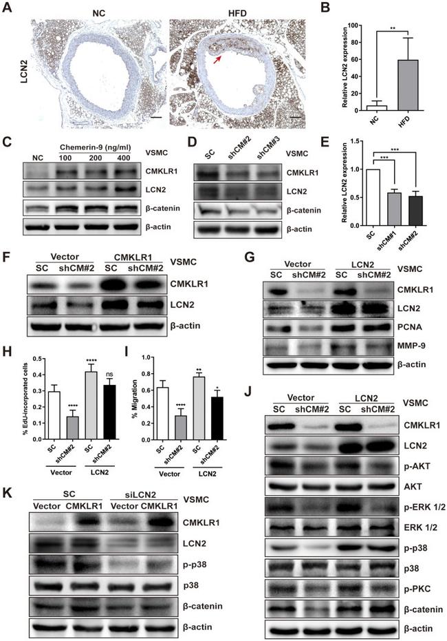 CMKLR1 Antibody in Western Blot (WB)