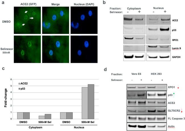 ACE2 Antibody in Western Blot (WB)