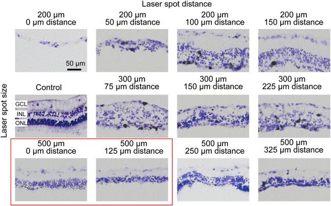 PKC alpha Antibody in Immunohistochemistry (IHC)