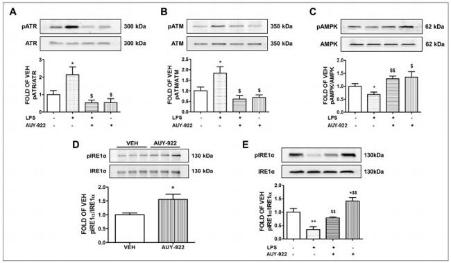 Phospho-IRE1 alpha (Ser724) Antibody in Western Blot (WB)