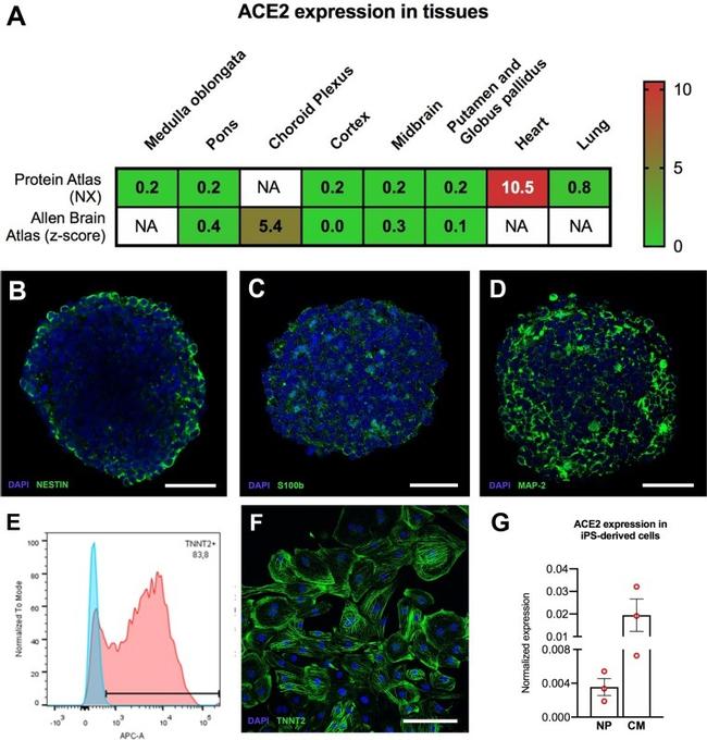 Cardiac Troponin T Antibody in Immunocytochemistry, Flow Cytometry (ICC/IF, Flow)