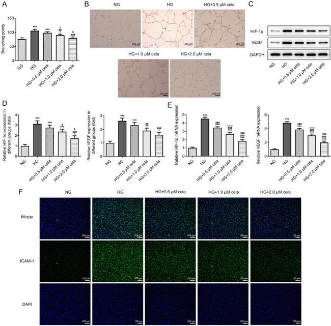 VEGF Antibody in Western Blot (WB)