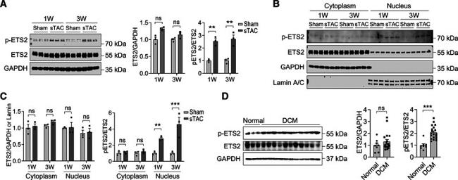 Phospho-ETS2 (Thr72) Antibody in Western Blot (WB)