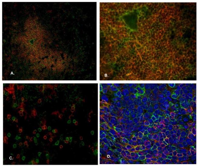 CD8 alpha Antibody in Immunohistochemistry (Frozen) (IHC (F))