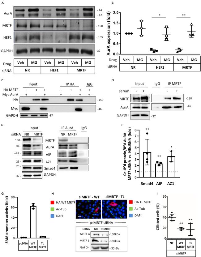 Aurora A Antibody in Western Blot (WB)