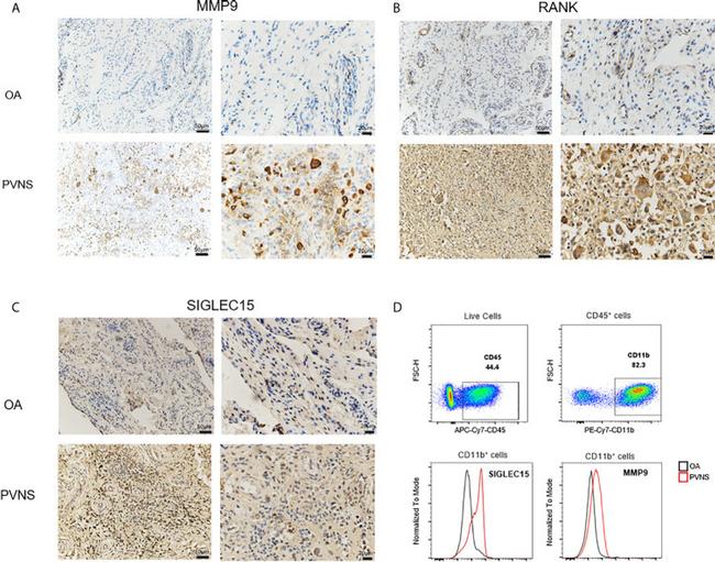 SIGLEC15 Antibody in Immunohistochemistry (IHC)