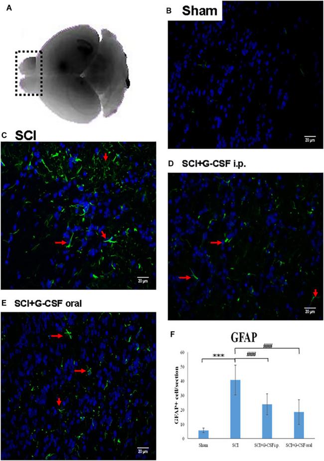 GFAP Antibody in Immunohistochemistry (IHC)