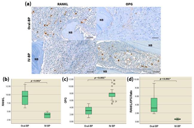 CD254 (RANK Ligand) Antibody in Immunohistochemistry (IHC)