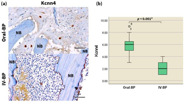 KCNN4 Antibody in Immunohistochemistry (IHC)