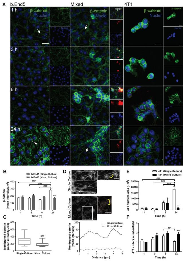 beta Catenin Antibody in Immunocytochemistry (ICC/IF)