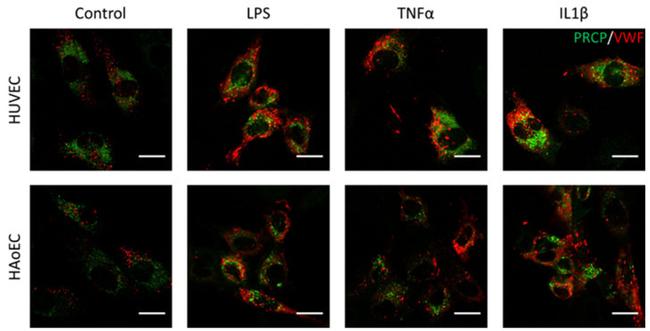 VWF Antibody in Immunocytochemistry (ICC/IF)