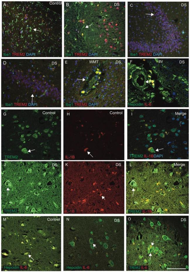 IL-6 Antibody in Immunohistochemistry (IHC)