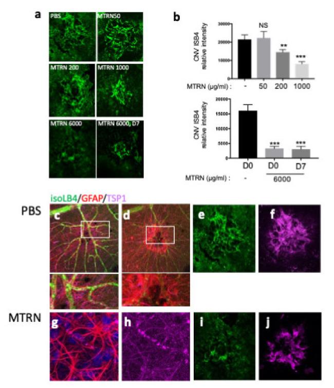 Thrombospondin 1 Antibody in Immunohistochemistry (IHC)