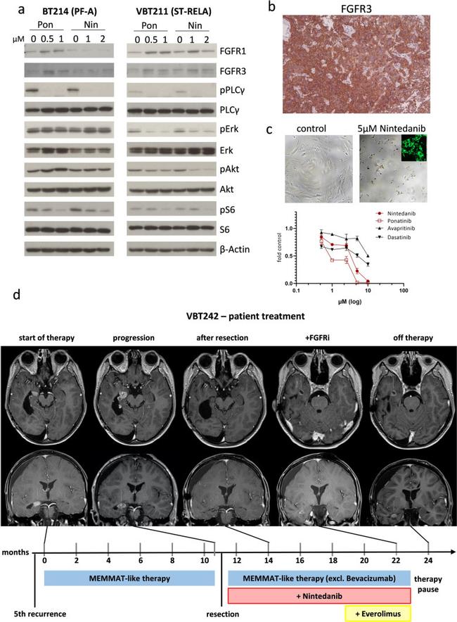 FGFR3 Antibody in Immunohistochemistry (IHC)