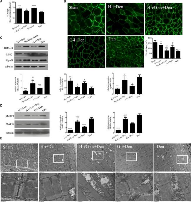 MURF1 Antibody in Western Blot (WB)