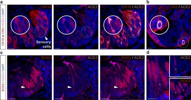 ACE2 Antibody in Immunohistochemistry (IHC)