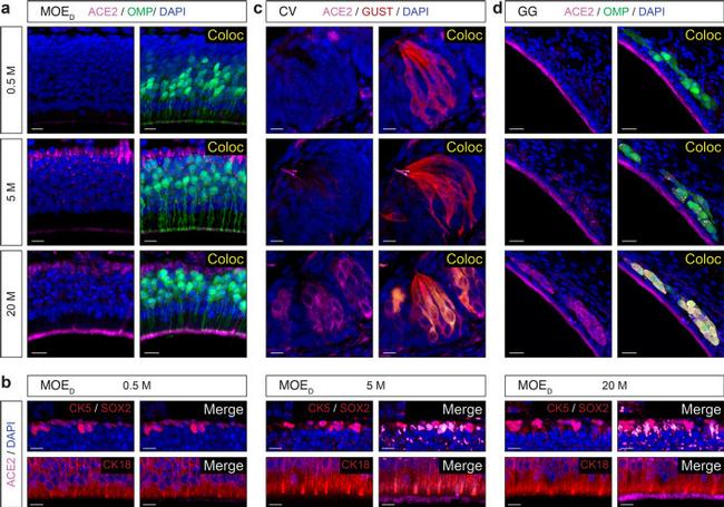 ACE2 Antibody in Immunohistochemistry (IHC)