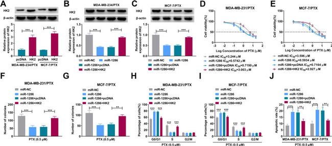 HK2 Antibody in Western Blot (WB)