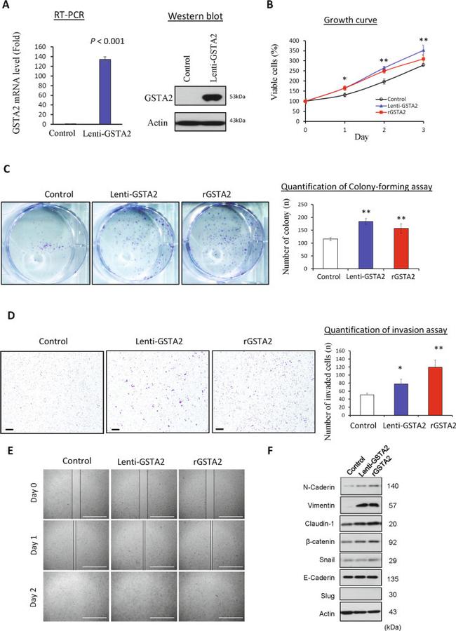 GSTA2 Antibody in Western Blot (WB)