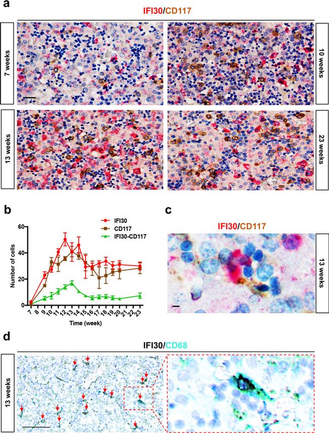 IFI30 Antibody in Immunohistochemistry (IHC)