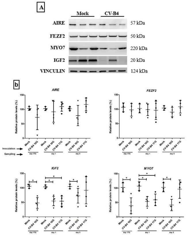 AIRE Antibody in Western Blot (WB)