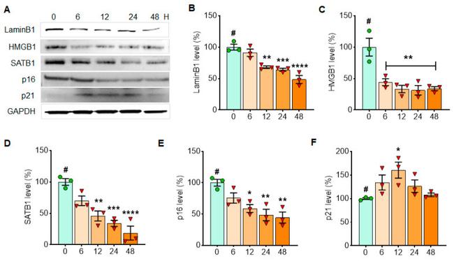 Lamin B1 Antibody in Western Blot (WB)