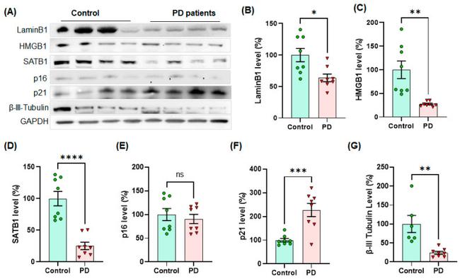 HMGB1 Antibody in Western Blot (WB)