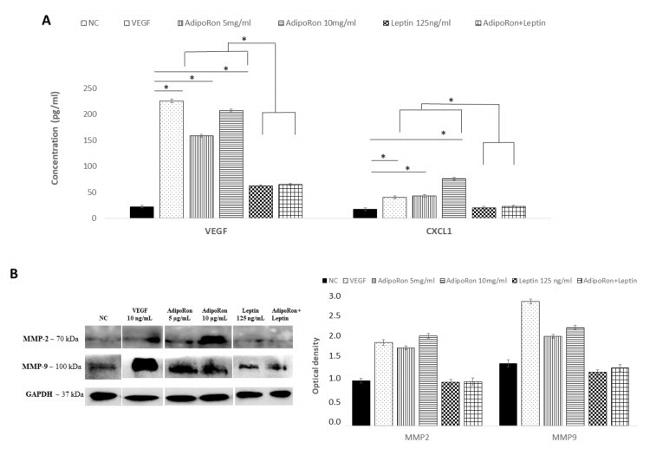 MMP9 Antibody in Western Blot (WB)