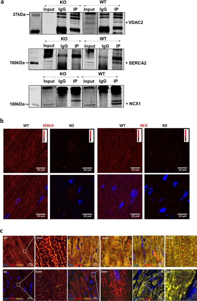 VDAC2 Antibody in Immunoprecipitation (IP)