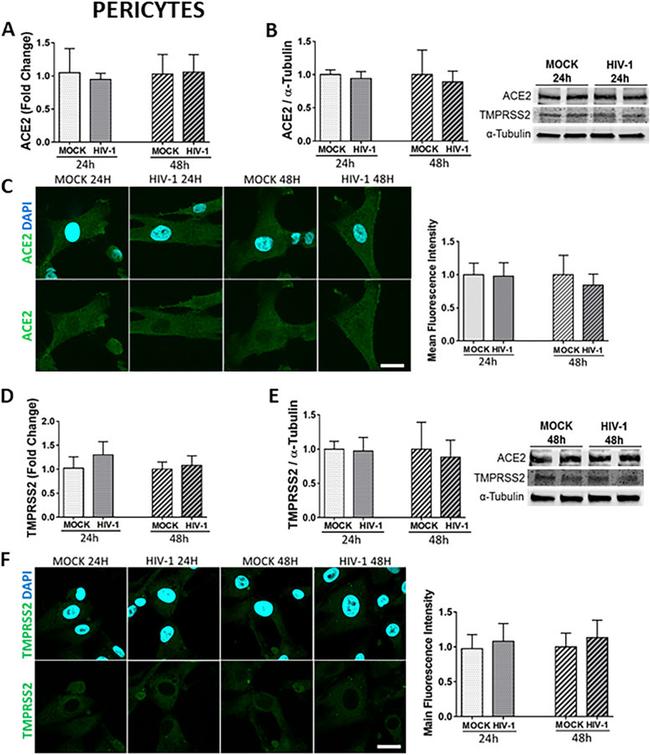 TMPRSS2 Antibody in Western Blot (WB)