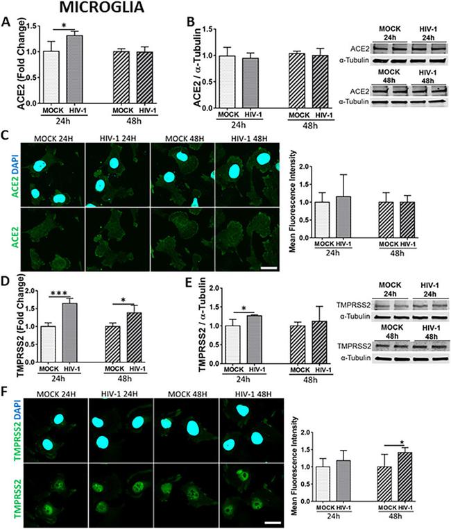 TMPRSS2 Antibody in Western Blot (WB)