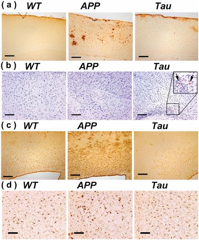 Phospho-Tau (Ser422) Antibody in Immunohistochemistry (IHC)