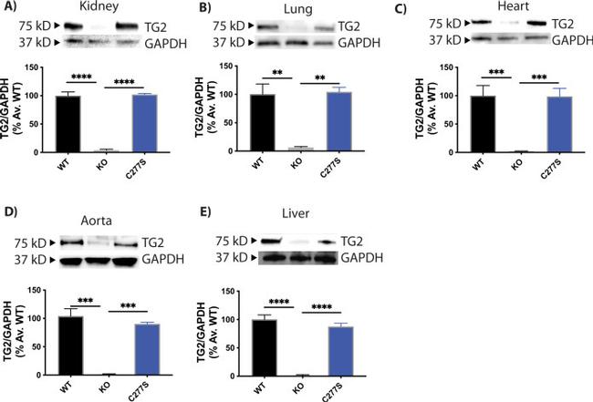 TGM2 Antibody in Western Blot (WB)