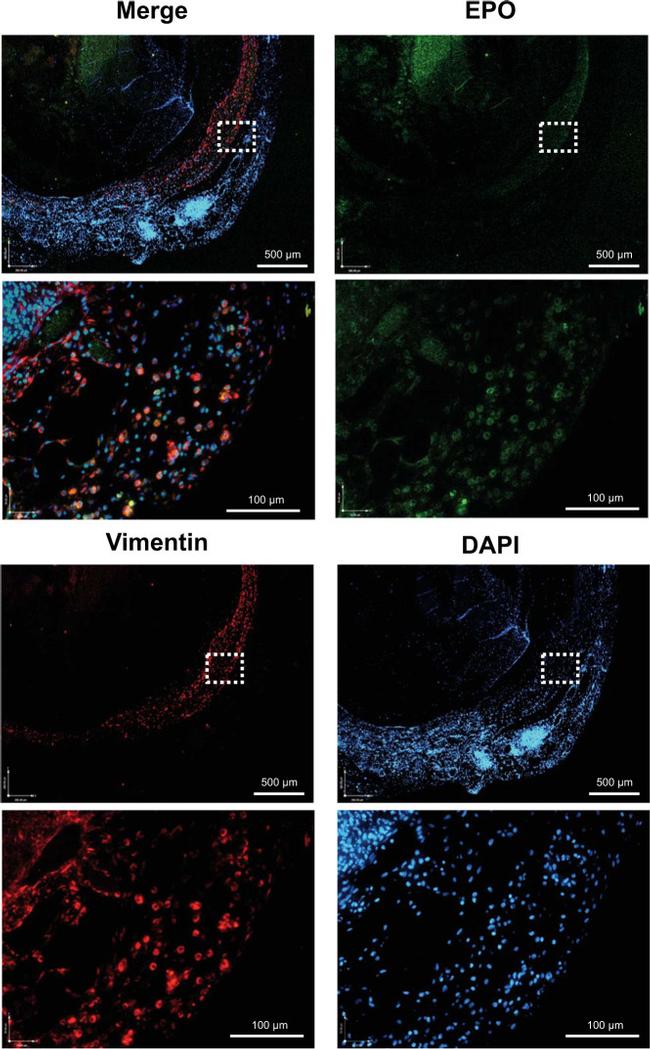 Epo Antibody in Immunohistochemistry (Paraffin) (IHC (P))