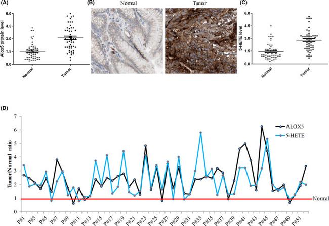 ALOX5 Antibody in Immunohistochemistry (Paraffin) (IHC (P))