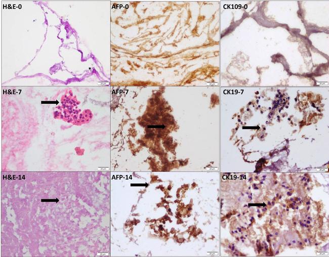 AFP Antibody in Immunohistochemistry (IHC)