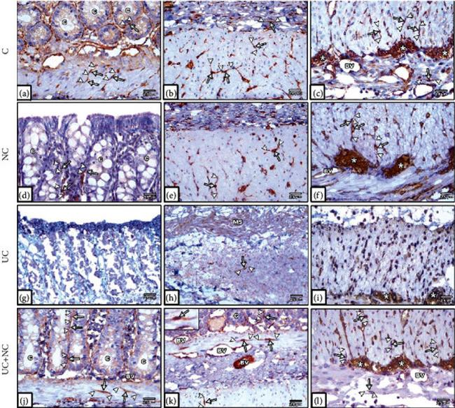 Vimentin Antibody in Immunohistochemistry (IHC)