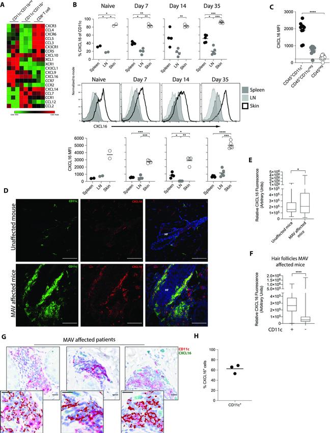 CXCL16 Antibody in Immunohistochemistry (IHC)