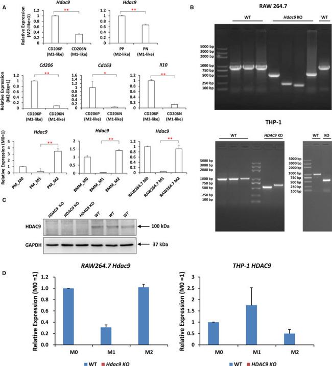 HDAC9 Antibody in Western Blot (WB)