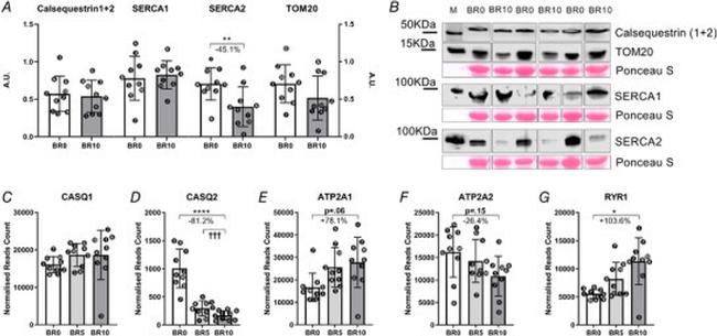 SERCA2 ATPase Antibody in Western Blot (WB)