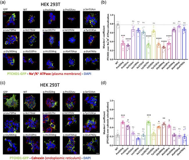 Calnexin Antibody in Immunocytochemistry (ICC/IF)