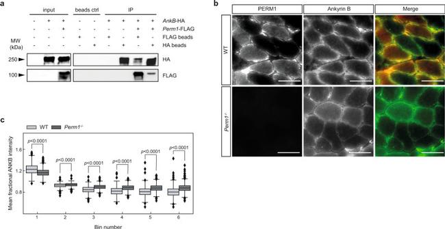 Ankyrin B Antibody in Immunohistochemistry (IHC)