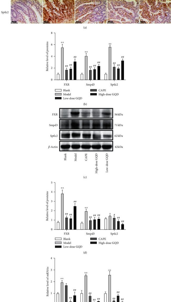 FXR Antibody in Western Blot, Immunohistochemistry (WB, IHC)