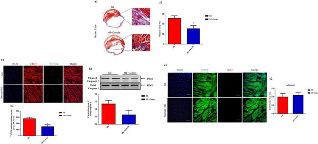 Cardiac Troponin T Antibody in Immunohistochemistry (IHC)