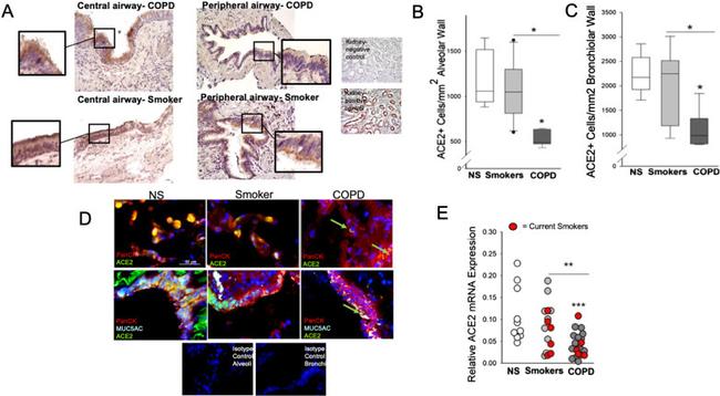 ACE2 Antibody in Immunohistochemistry (IHC)