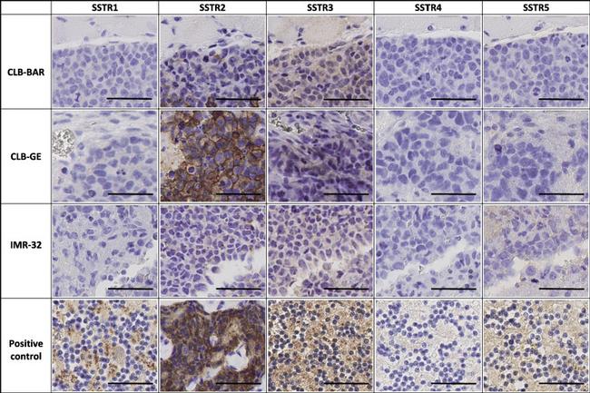 SSTR3 Antibody in Immunohistochemistry (IHC)