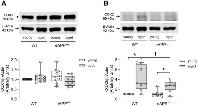 COX1 Antibody in Western Blot (WB)