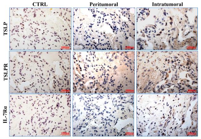 TSLP Antibody in Immunohistochemistry (IHC)