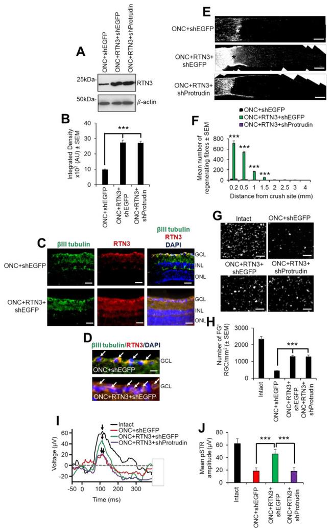 GAP43 Antibody in Immunohistochemistry (IHC)